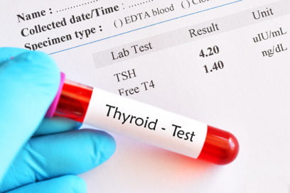 thyroid function test