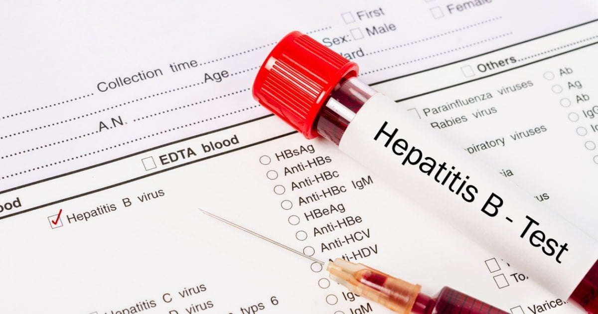 Hepatitis B Virus Test